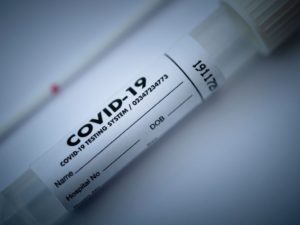 Υποχρέωση για 2 εβδομαδιαία διαγνωστικά test Covid-19 στον ιδιωτικό τομέα